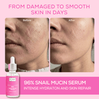 96 Snail Mucin serum for hydration and skin repair results by Pink Beauty