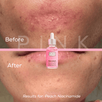 Peach Me Up-10% Niacinamide Serum