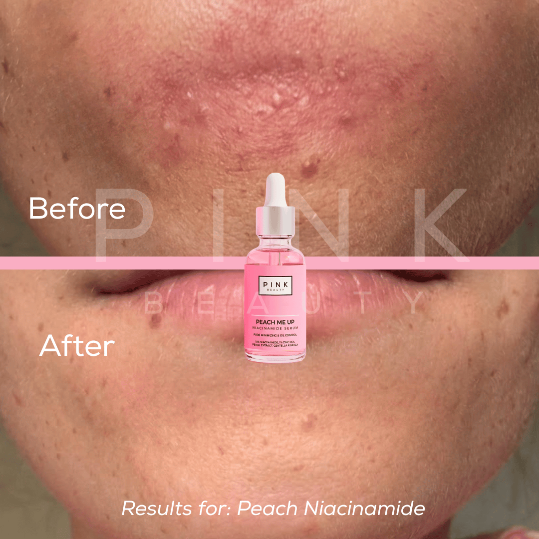 Skin Revival Duo