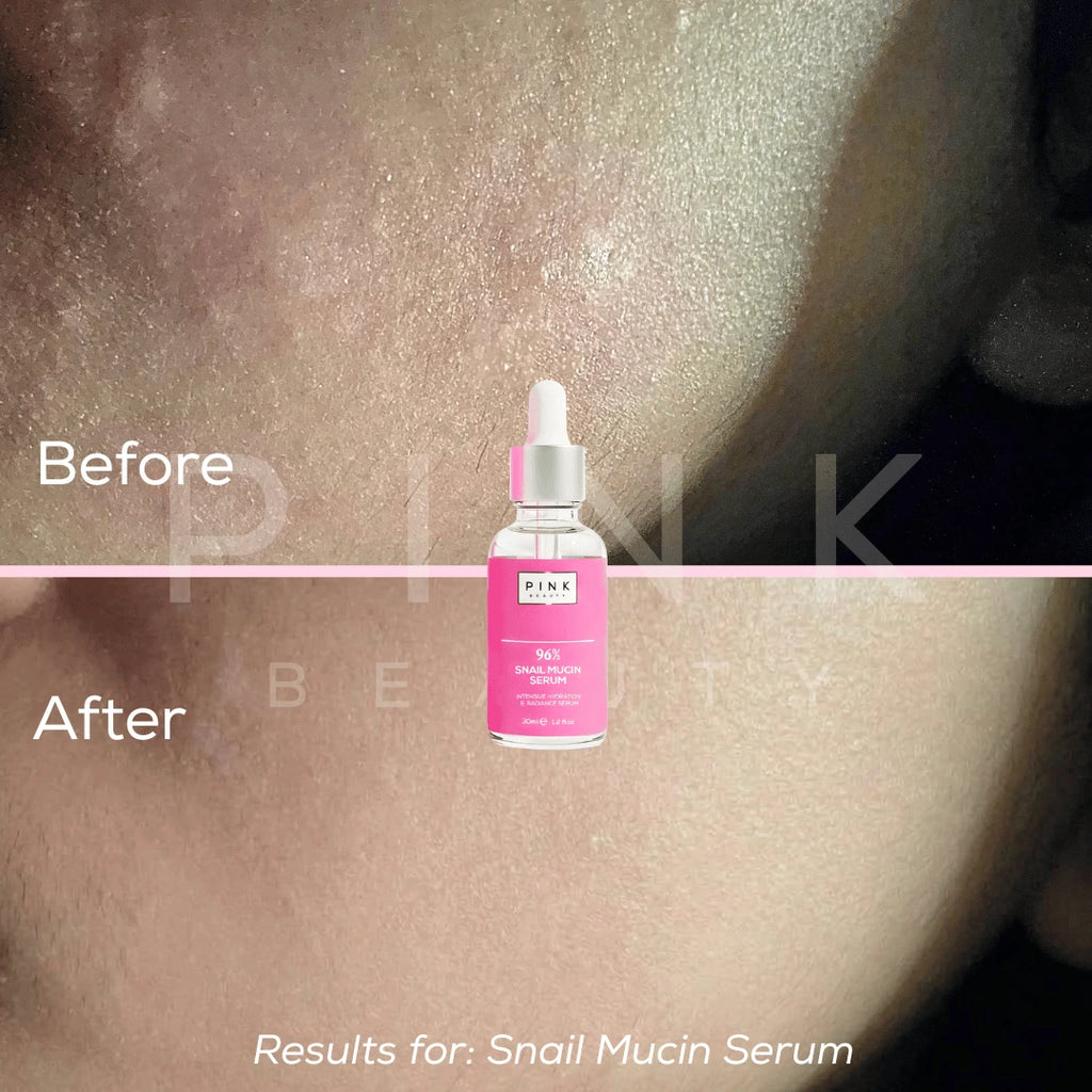 Pink Beauty 96% Snail Mucin Serum, hydrating Korean skincare for dry and dehydrated skin. Helps support the skin barrier, improve skin texture, and achieve plump, smooth, glowing glass skin.