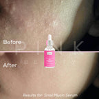 Pink Beauty 96% Snail Mucin Serum, hydrating Korean skincare for dry and dehydrated skin. Helps support the skin barrier, improve skin texture, and achieve plump, smooth, glowing glass skin.