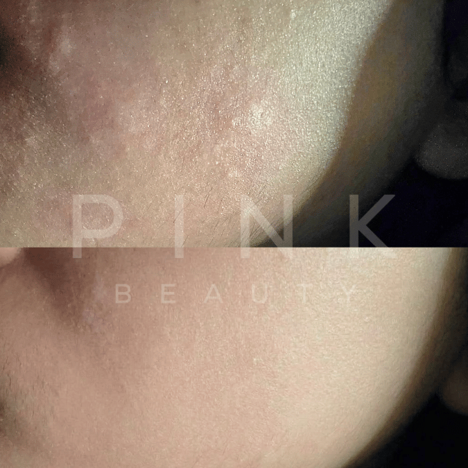 Pink Beauty 96% Snail Mucin Serum, hydrating Korean skincare for dry and dehydrated skin. Helps support the skin barrier, improve skin texture, and achieve plump, smooth, glowing glass skin.