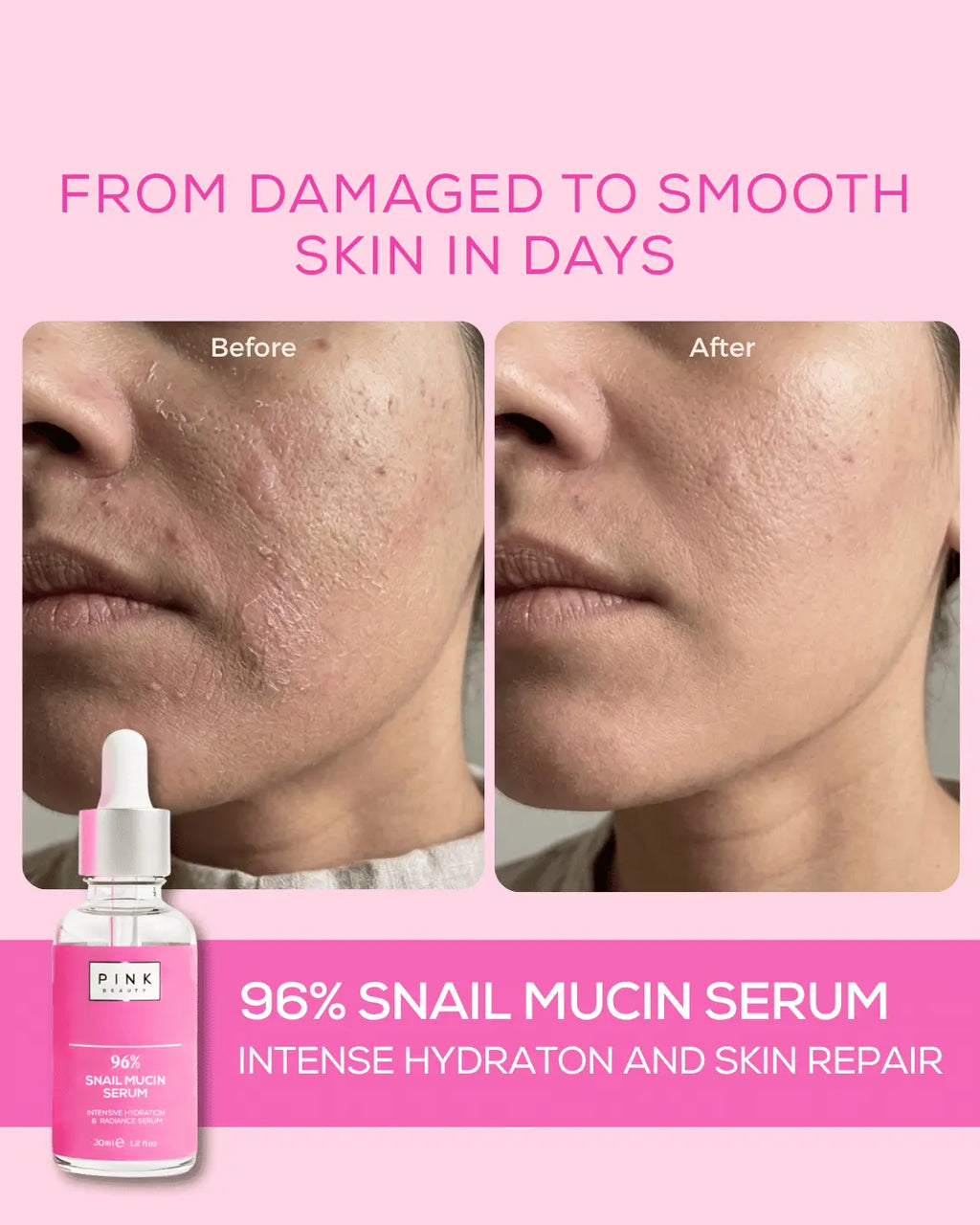 Before and after comparison of skin with a snail mucin serum on a pink background